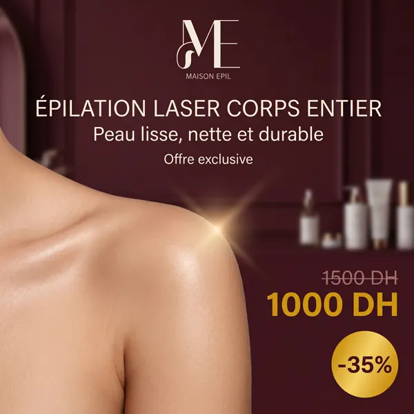 Epilation laser